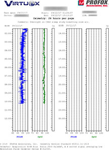 Overnight Oximetry Hourly Report (Profox Edition)